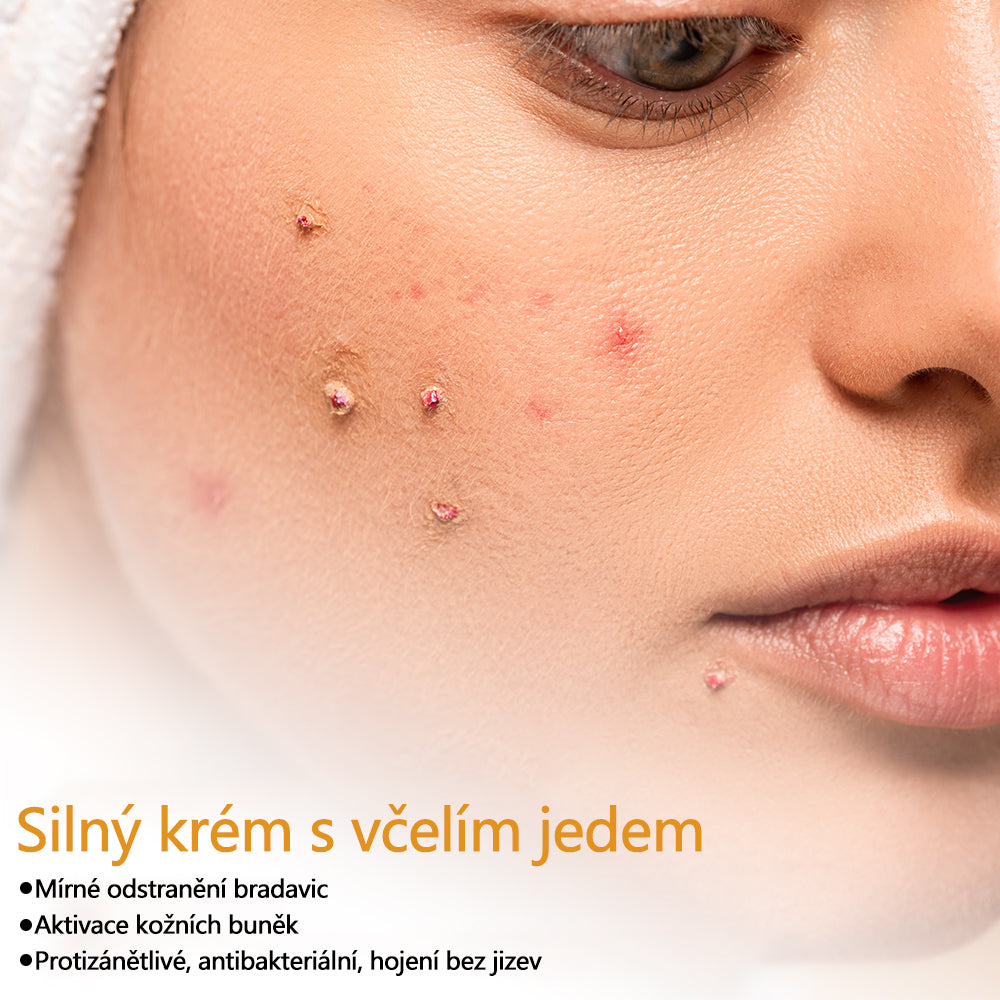Twinsun™ Extra Silný Krém s včelím jedem, certifikovaný EMA💖 Na ošetření bradavic, kožních výrůstků, infekcí a keratózy, vyhlazuje nerovnoměrný povrch pokožky🐝