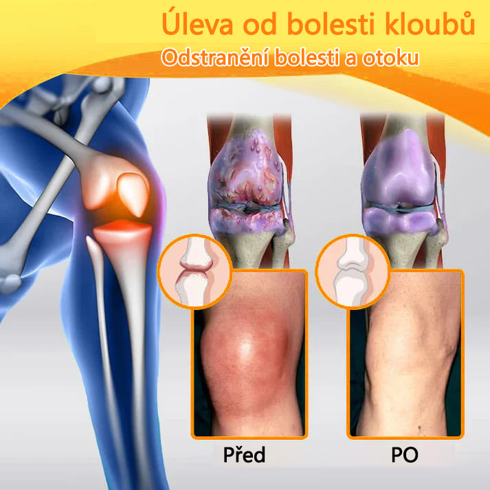 TLOPA® Krém s botulotoxinem a včelím jedem 🔥 (Speciálně pro seniory & doporučeno ortopedickými specialisty) 🐝🐝