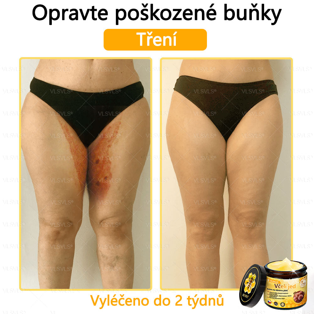 🐝VLSVLS™ Krém s včelím jedem – doporučeno kožními lékaři 🧑⚕️ Na různé kožní problémy – fakt účinný a šetrný pomocník🍃