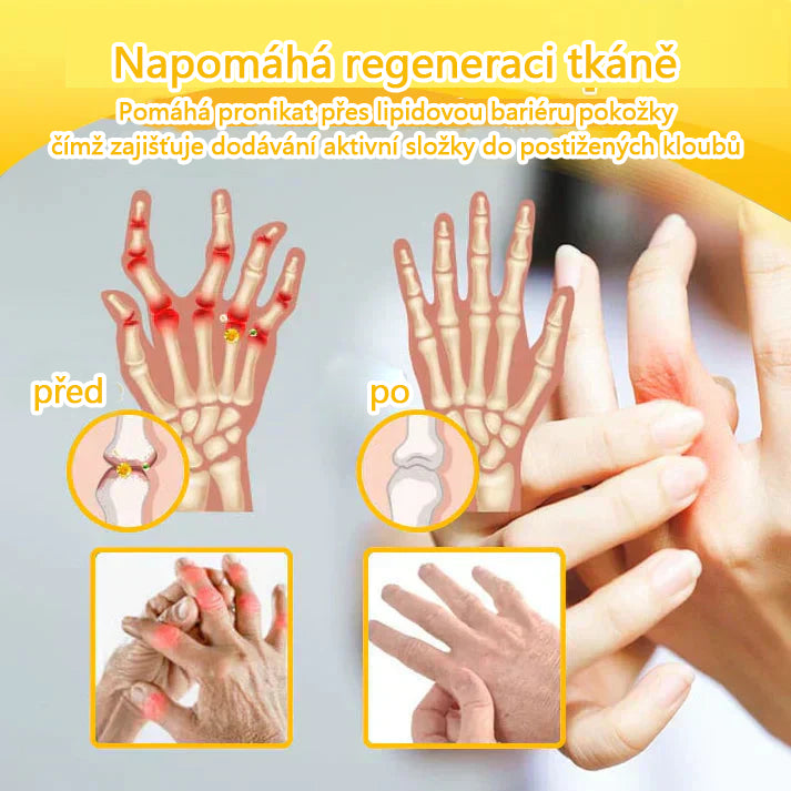 TLOPA® Krém s botulotoxinem a včelím jedem 🔥 (Speciálně pro seniory & doporučeno ortopedickými specialisty) 🐝🐝