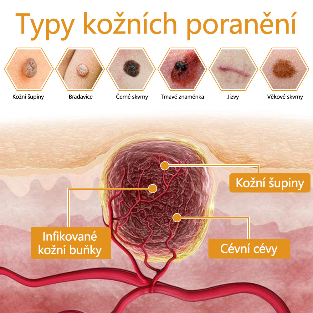 Twinsun™ Extra Silný Krém s včelím jedem, certifikovaný EMA💖 Na ošetření bradavic, kožních výrůstků, infekcí a keratózy, vyhlazuje nerovnoměrný povrch pokožky🐝