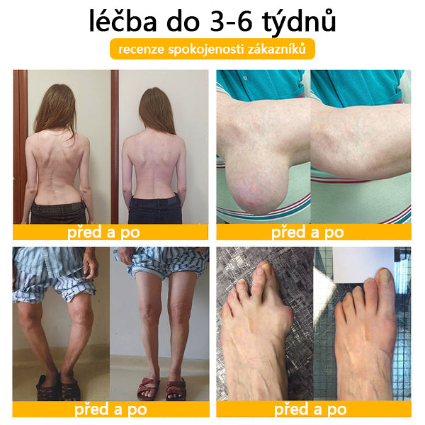 TLOPA® Krém s botulotoxinem a včelím jedem 🔥 (Speciálně pro seniory & doporučeno ortopedickými specialisty) 🐝🐝