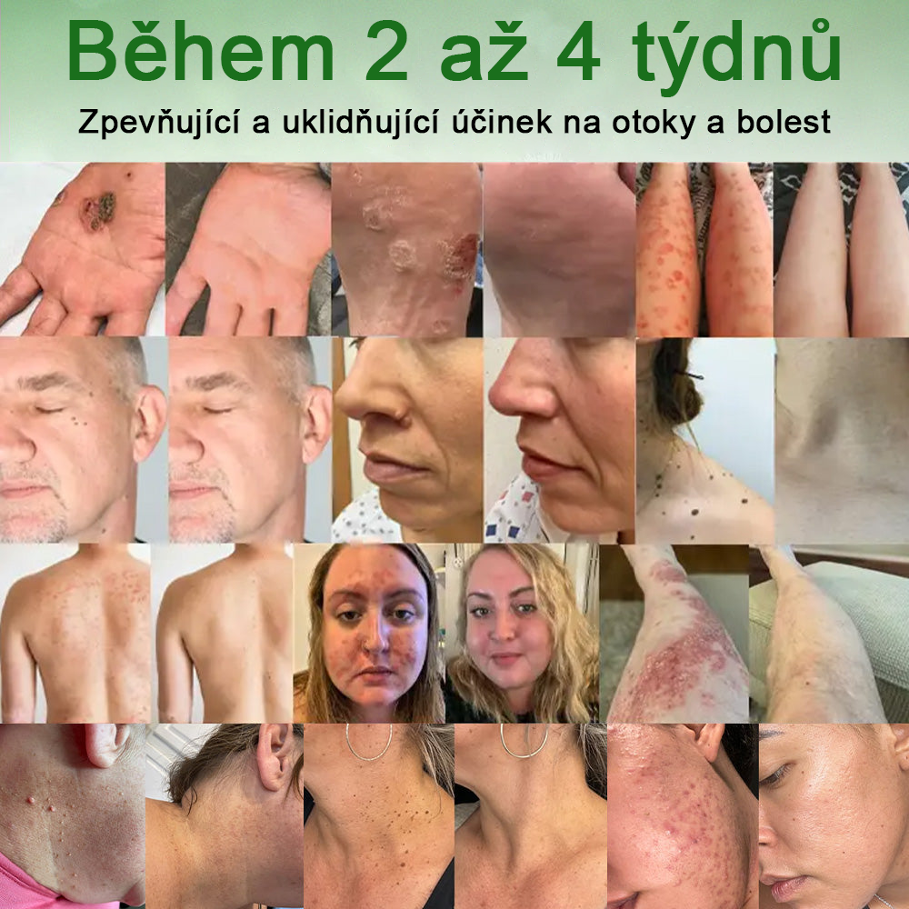 ✅ S osvědčením SÚKL 🌿 Twinsun® Tea Tree Krém – Odstraňuje nedokonalosti pokožky, regeneruje poškozenou pleť, dodává jí zářivý vzhled a poskytuje omlazující péči 🌳