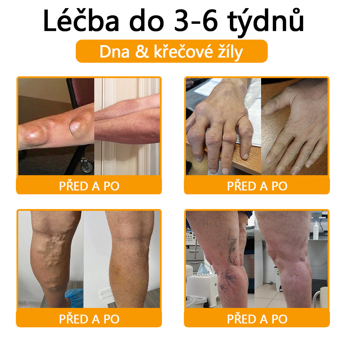 TLOPA® Krém s botulotoxinem a včelím jedem 🔥 (Speciálně pro seniory & doporučeno ortopedickými specialisty) 🐝🐝