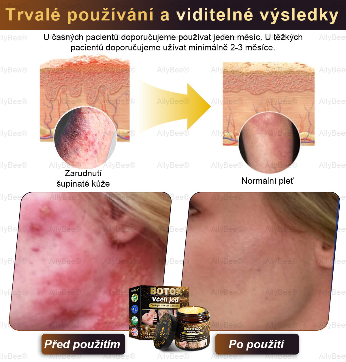 👨🔬AllyBee® Botox Krém na ošetření pleti proti stárnutí, hydratační, oprava pleti, vyrovnání tónu pleti, léčba akné a tmavých skvrn, odstraňování bradavic a mateřských znamének
