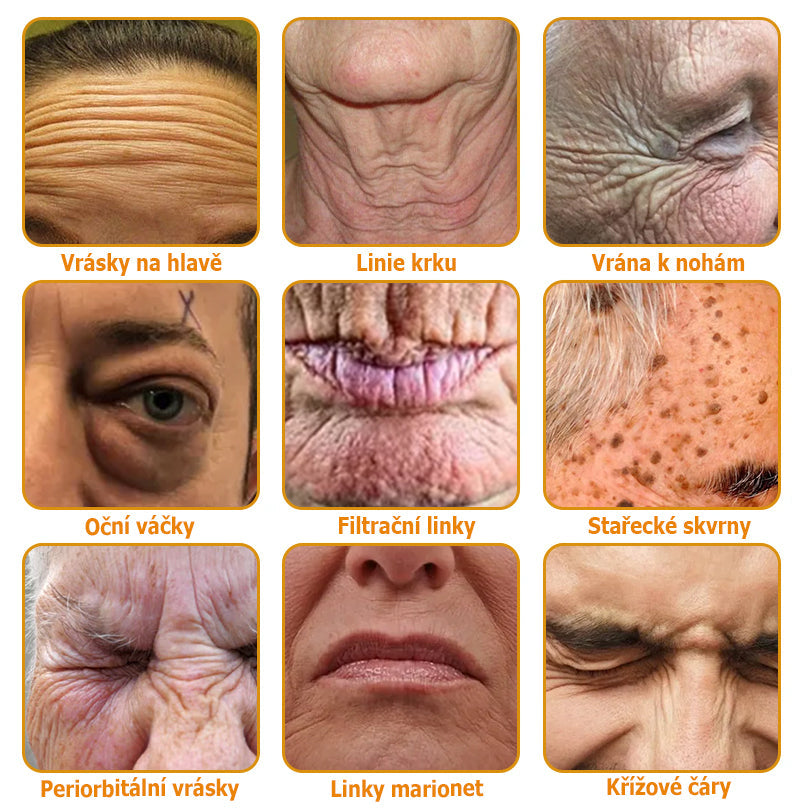 👨🔬AllyBee® Botox Krém na ošetření pleti proti stárnutí, hydratační, oprava pleti, vyrovnání tónu pleti, léčba akné a tmavých skvrn, odstraňování bradavic a mateřských znamének