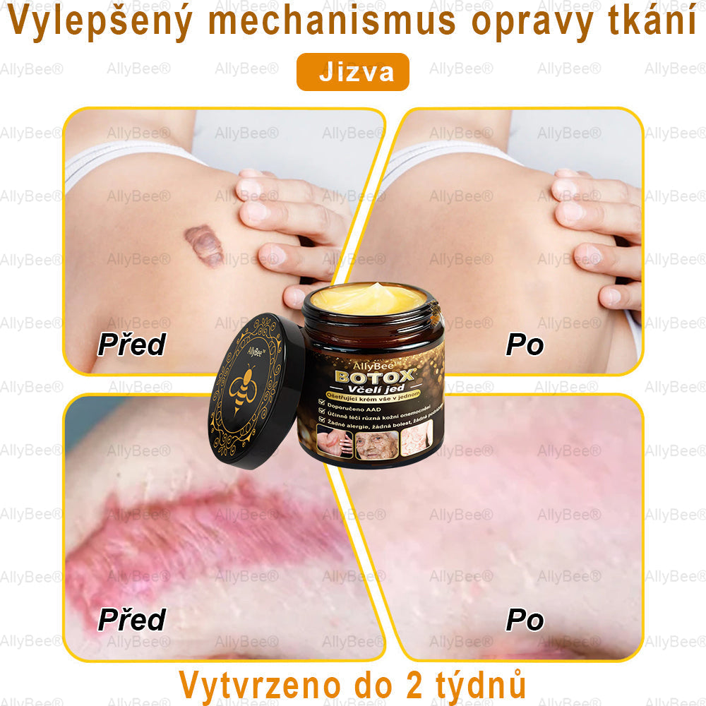 👨🔬AllyBee® Botox Krém na ošetření pleti proti stárnutí, hydratační, oprava pleti, vyrovnání tónu pleti, léčba akné a tmavých skvrn, odstraňování bradavic a mateřských znamének