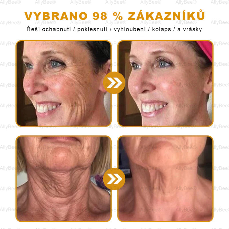 👨🔬AllyBee® Botox Krém na ošetření pleti proti stárnutí, hydratační, oprava pleti, vyrovnání tónu pleti, léčba akné a tmavých skvrn, odstraňování bradavic a mateřských znamének