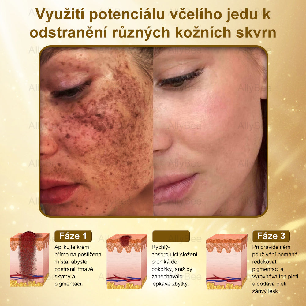👨🔬AllyBee® Botox Krém na ošetření pleti proti stárnutí, hydratační, oprava pleti, vyrovnání tónu pleti, léčba akné a tmavých skvrn, odstraňování bradavic a mateřských znamének