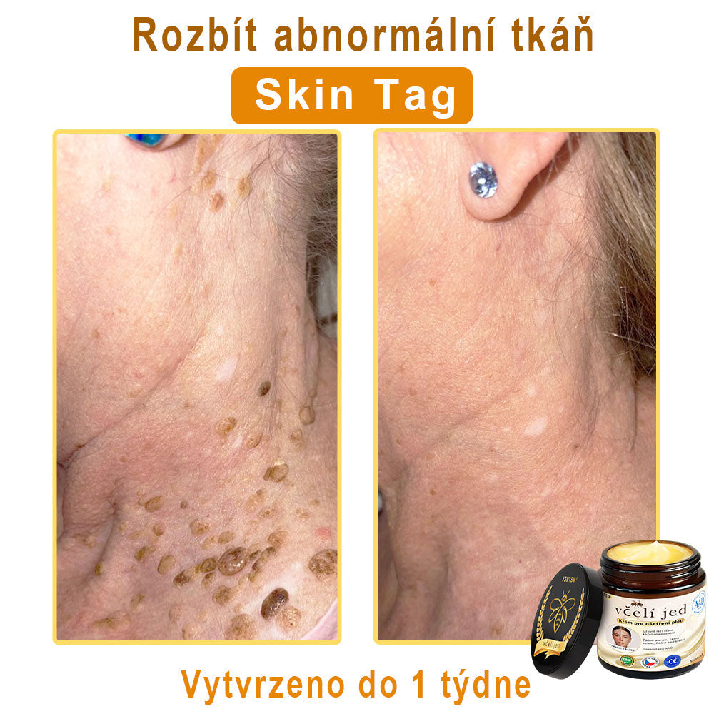 💥 YSMYSM® Krém na opravu pleti pro celé tělo: proti stárnutí, hydratace, oprava pleti, sjednocení tónu pleti, léčba akné a tmavých skvrn, odstraňování bradavic a znamének, úleva při psoriáze