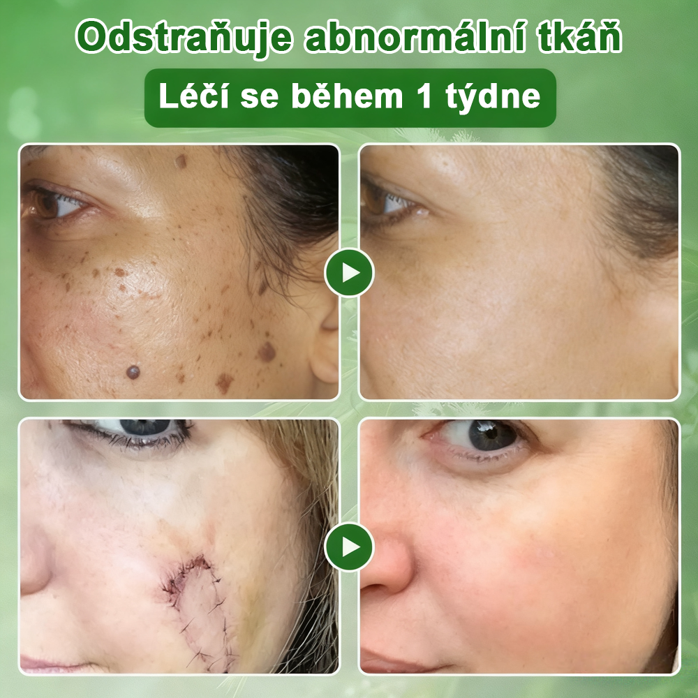 ✅ S osvědčením SÚKL 🌿 Twinsun® Tea Tree Krém – Odstraňuje nedokonalosti pokožky, regeneruje poškozenou pleť, dodává jí zářivý vzhled a poskytuje omlazující péči 🌳