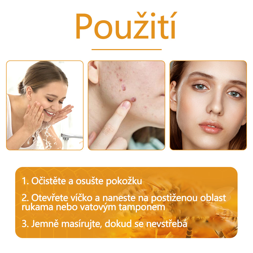 Twinsun™ Extra Silný Krém s včelím jedem, certifikovaný EMA💖 Na ošetření bradavic, kožních výrůstků, infekcí a keratózy, vyhlazuje nerovnoměrný povrch pokožky🐝