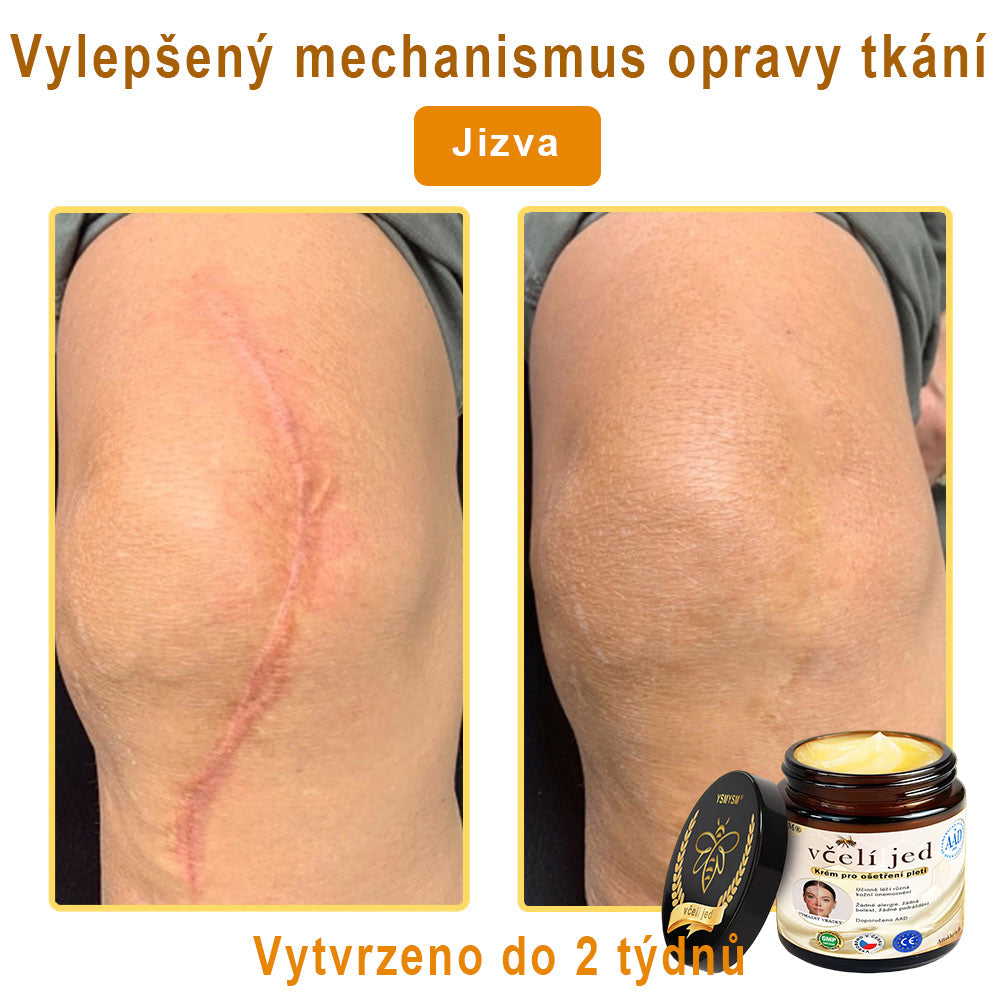 💥 YSMYSM® Krém na opravu pleti pro celé tělo: proti stárnutí, hydratace, oprava pleti, sjednocení tónu pleti, léčba akné a tmavých skvrn, odstraňování bradavic a znamének, úleva při psoriáze