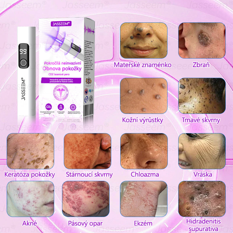 🌿𝐉𝐚𝐬𝐬𝐞𝐞𝐦® Pokročilé neinvazivní pero s CO₂ laserem na opravu pokožky 💕 (šetrně odstraňuje bradavice, mateřská znaménka, stařecké skvrny a kožní značky - bez bolesti a rozruchu!)🌿