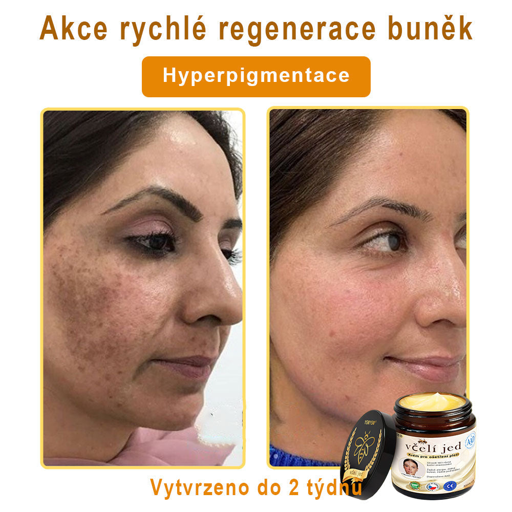 💥 YSMYSM® Krém na opravu pleti pro celé tělo: proti stárnutí, hydratace, oprava pleti, sjednocení tónu pleti, léčba akné a tmavých skvrn, odstraňování bradavic a znamének, úleva při psoriáze