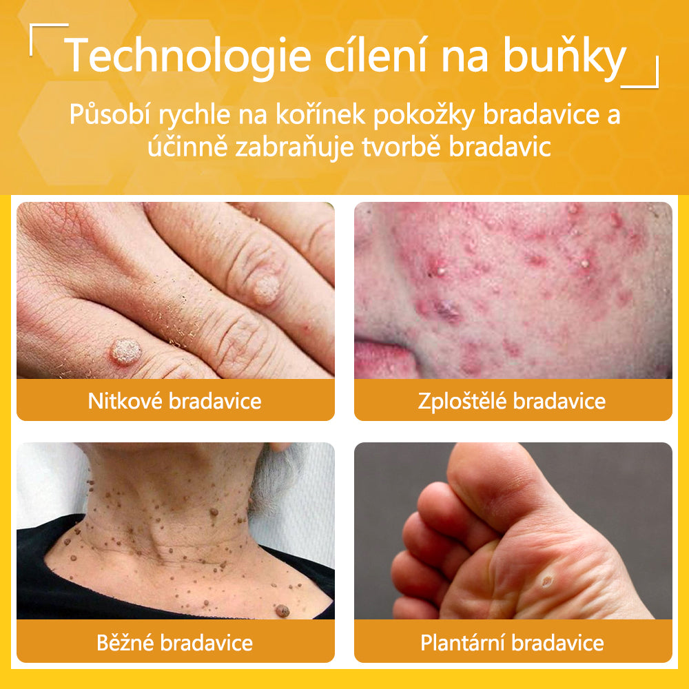 Twinsun™ Extra Silný Krém s včelím jedem, certifikovaný EMA💖 Na ošetření bradavic, kožních výrůstků, infekcí a keratózy, vyhlazuje nerovnoměrný povrch pokožky🐝