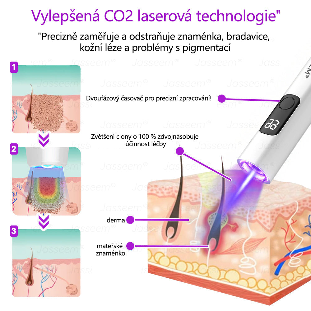 🌿𝐉𝐚𝐬𝐬𝐞𝐞𝐦® Pokročilé neinvazivní pero s CO₂ laserem na opravu pokožky 💕 (šetrně odstraňuje bradavice, mateřská znaménka, stařecké skvrny a kožní značky - bez bolesti a rozruchu!)🌿