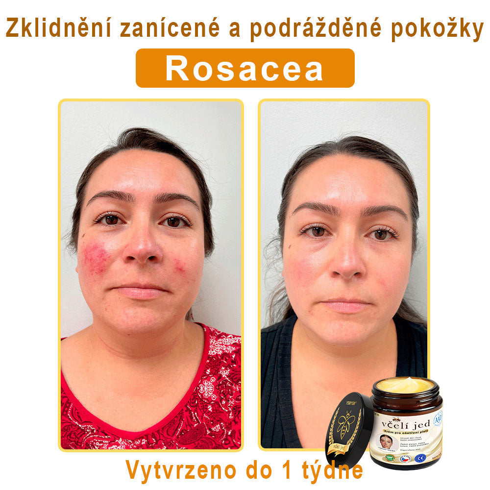 💥 YSMYSM® Krém na opravu pleti pro celé tělo: proti stárnutí, hydratace, oprava pleti, sjednocení tónu pleti, léčba akné a tmavých skvrn, odstraňování bradavic a znamének, úleva při psoriáze