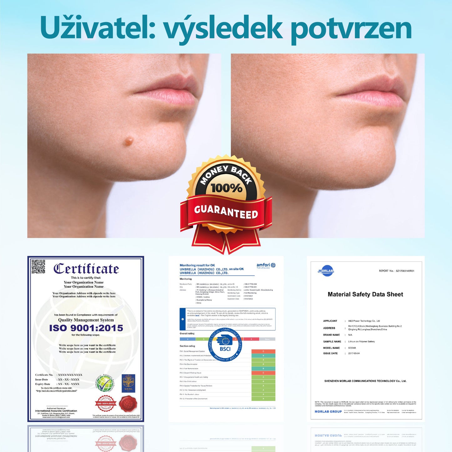 RICPIND® DermaLite laserové pero na odstranění mateřských znamének a bradavic