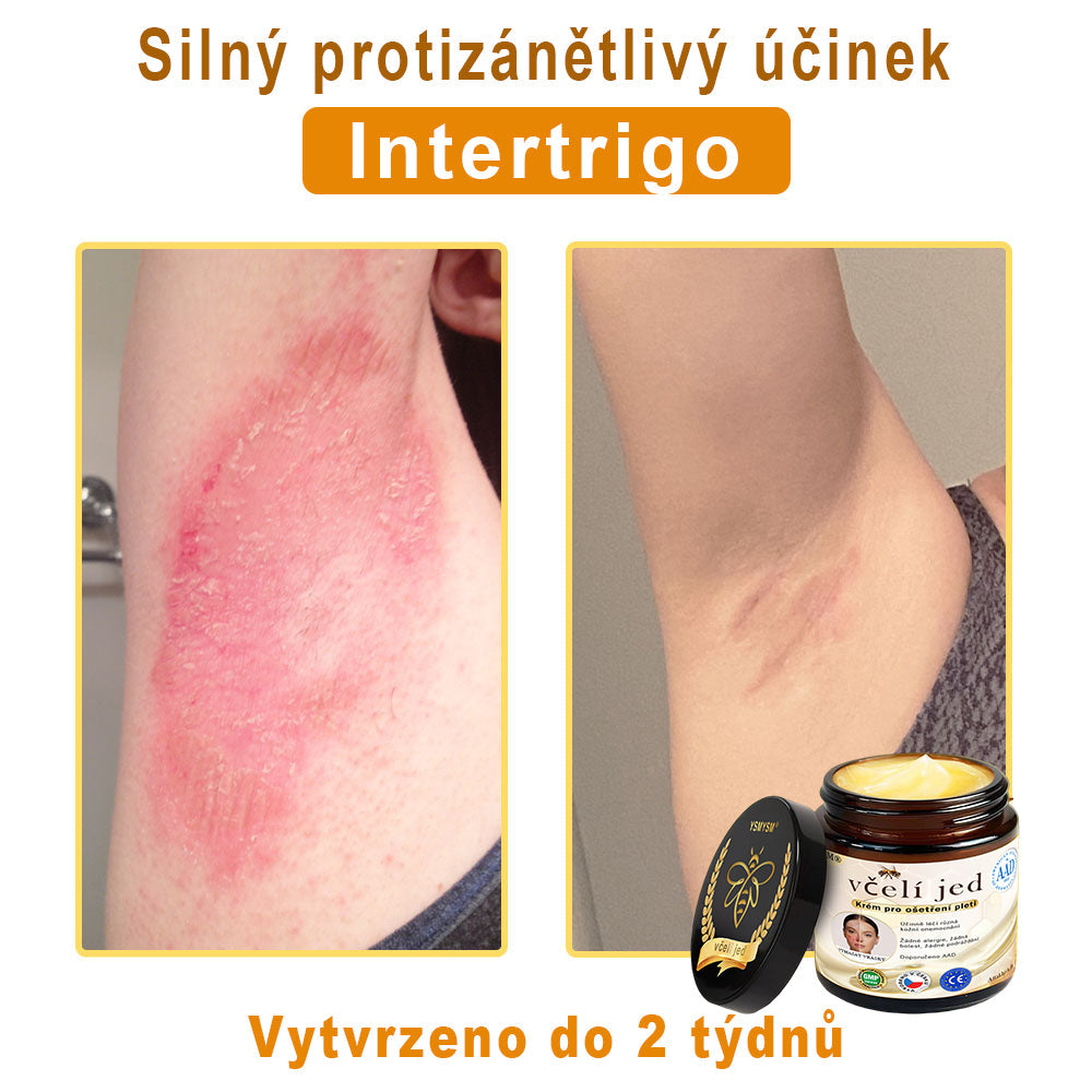 💥 YSMYSM® Krém na opravu pleti pro celé tělo: proti stárnutí, hydratace, oprava pleti, sjednocení tónu pleti, léčba akné a tmavých skvrn, odstraňování bradavic a znamének, úleva při psoriáze