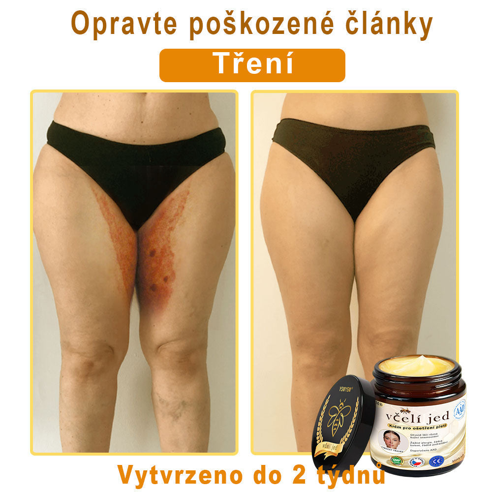 💥 YSMYSM® Krém na opravu pleti pro celé tělo: proti stárnutí, hydratace, oprava pleti, sjednocení tónu pleti, léčba akné a tmavých skvrn, odstraňování bradavic a znamének, úleva při psoriáze