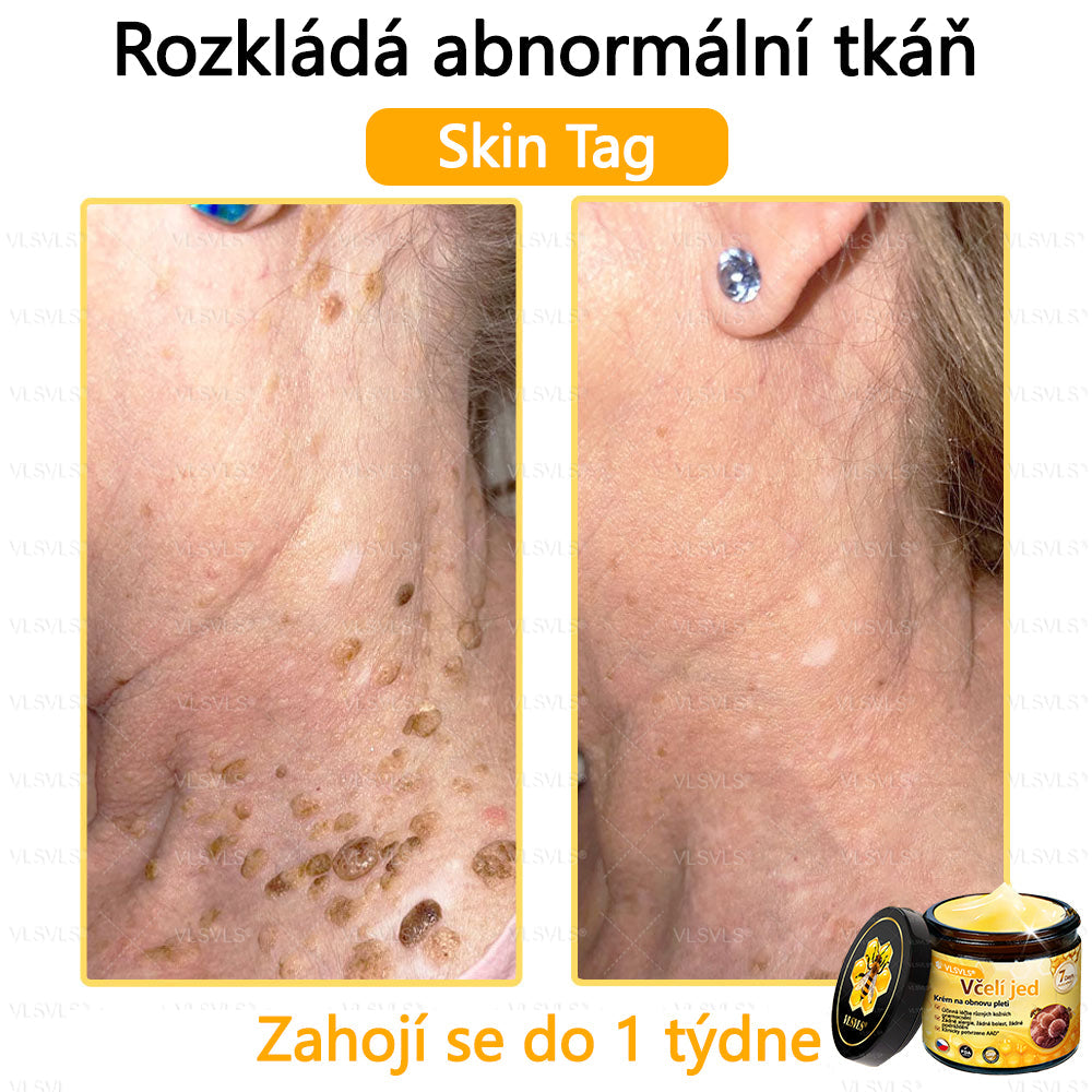 🐝VLSVLS™ Krém s včelím jedem – doporučeno kožními lékaři 🧑⚕️ Na různé kožní problémy – fakt účinný a šetrný pomocník🍃