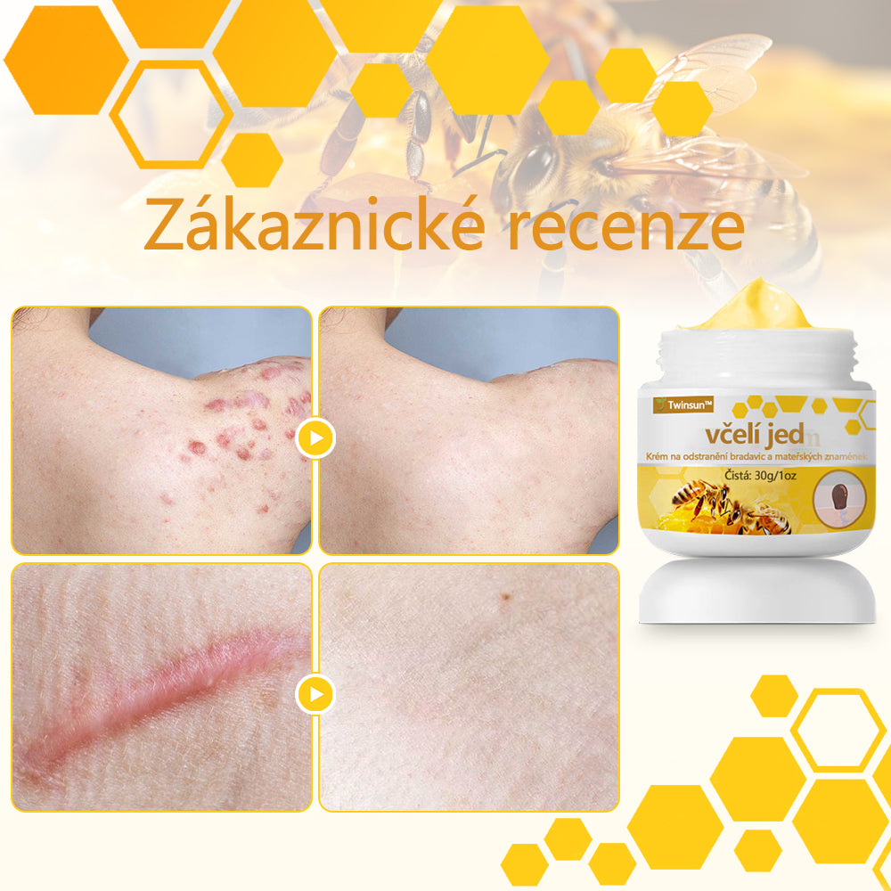 Twinsun™ Extra Silný Krém s včelím jedem, certifikovaný EMA💖 Na ošetření bradavic, kožních výrůstků, infekcí a keratózy, vyhlazuje nerovnoměrný povrch pokožky🐝
