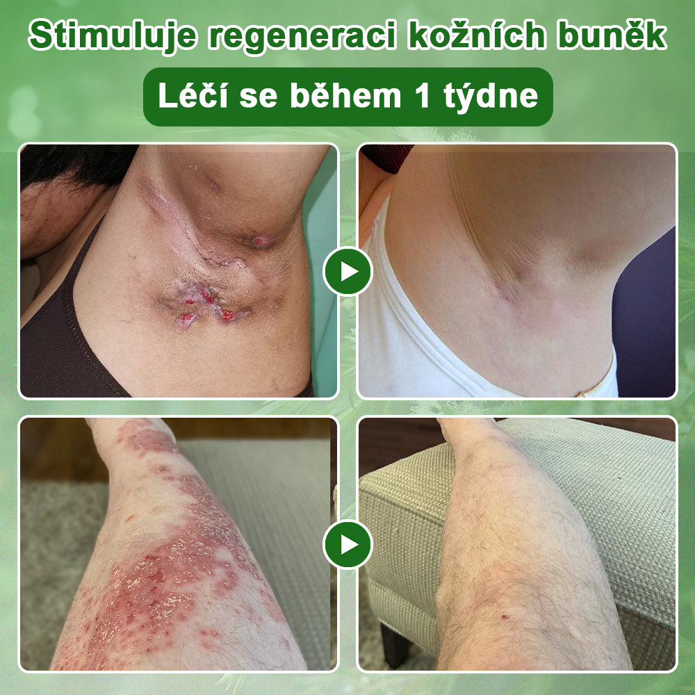 ✅ S osvědčením SÚKL 🌿 Twinsun® Tea Tree Krém – Odstraňuje nedokonalosti pokožky, regeneruje poškozenou pleť, dodává jí zářivý vzhled a poskytuje omlazující péči 🌳