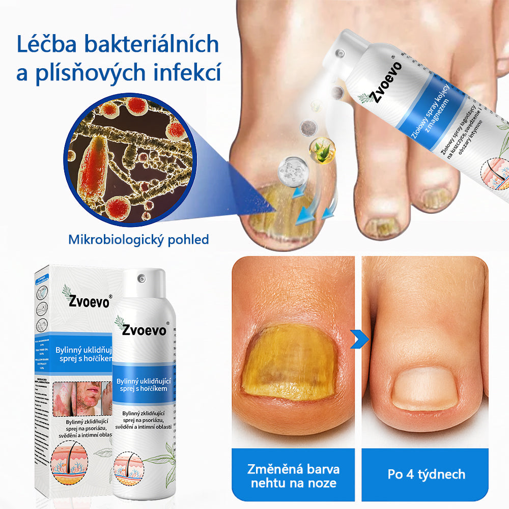 ✅ Oficiální obchod: Zvoevo® Magnesium bylinný sprej na lupénku ⚕️ EMA certifikace (zmírňuje lupénku a ekzém, léčí akné a bradavice, podporuje hojení bakteriálních infekcí, snižuje kloubní a neuropatickou bolest)