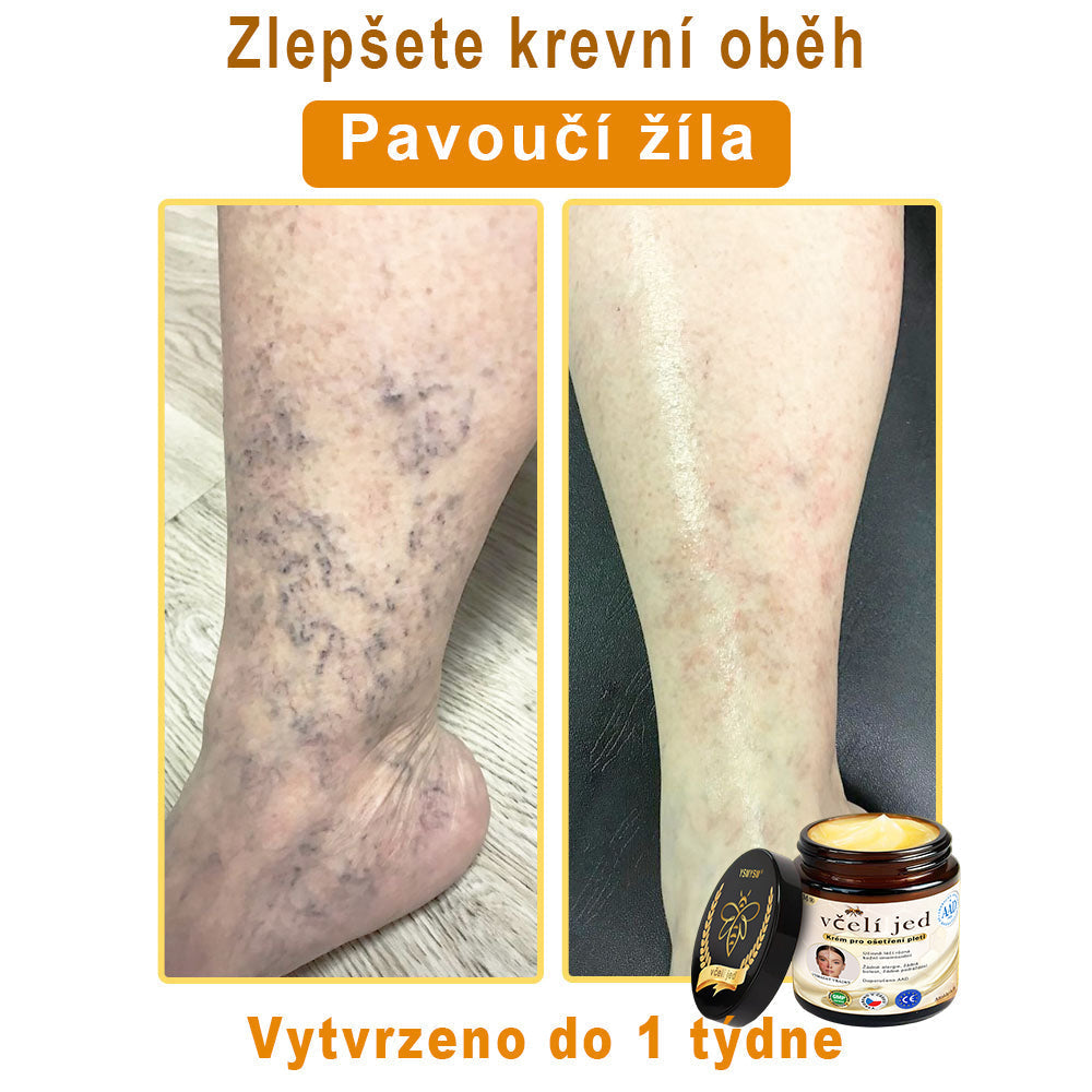 💥 YSMYSM® Krém na opravu pleti pro celé tělo: proti stárnutí, hydratace, oprava pleti, sjednocení tónu pleti, léčba akné a tmavých skvrn, odstraňování bradavic a znamének, úleva při psoriáze