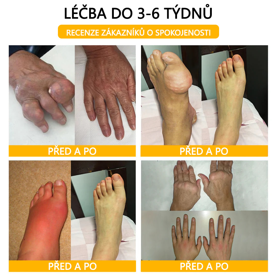 TLOPA® Krém s botulotoxinem a včelím jedem 🔥 (Speciálně pro seniory & doporučeno ortopedickými specialisty) 🐝🐝