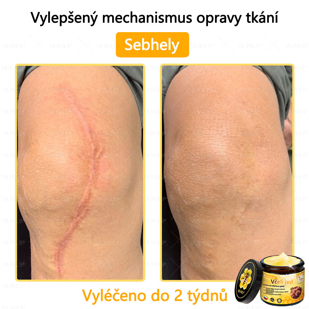 🐝VLSVLS™ Krém s včelím jedem – doporučeno kožními lékaři 🧑⚕️ Na různé kožní problémy – fakt účinný a šetrný pomocník🍃