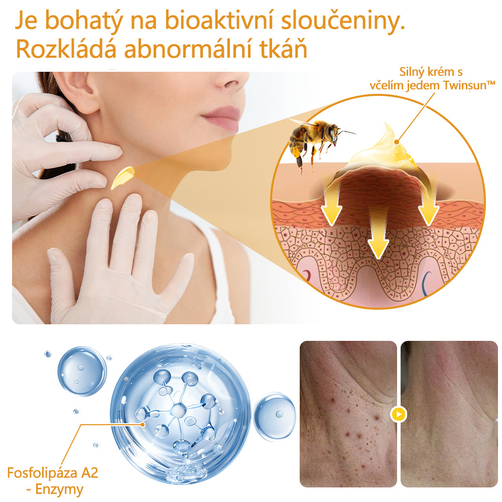 Twinsun™ Extra Silný Krém s včelím jedem, certifikovaný EMA💖 Na ošetření bradavic, kožních výrůstků, infekcí a keratózy, vyhlazuje nerovnoměrný povrch pokožky🐝
