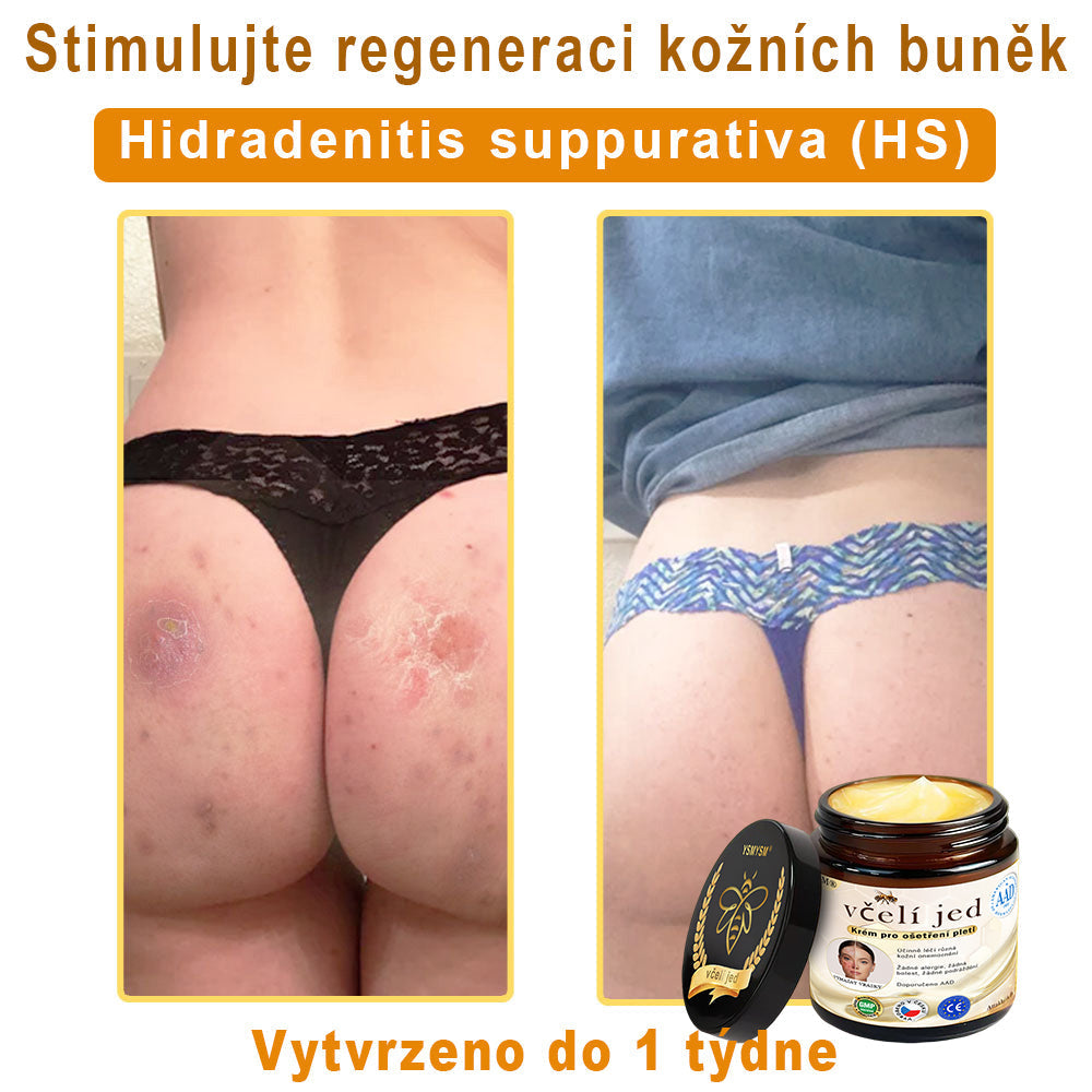 💥 YSMYSM® Krém na opravu pleti pro celé tělo: proti stárnutí, hydratace, oprava pleti, sjednocení tónu pleti, léčba akné a tmavých skvrn, odstraňování bradavic a znamének, úleva při psoriáze