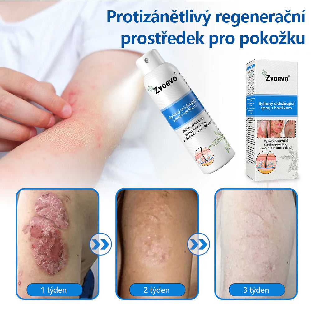 ✅ Oficiální obchod: Zvoevo® Magnesium bylinný sprej na lupénku ⚕️ EMA certifikace (zmírňuje lupénku a ekzém, léčí akné a bradavice, podporuje hojení bakteriálních infekcí, snižuje kloubní a neuropatickou bolest)