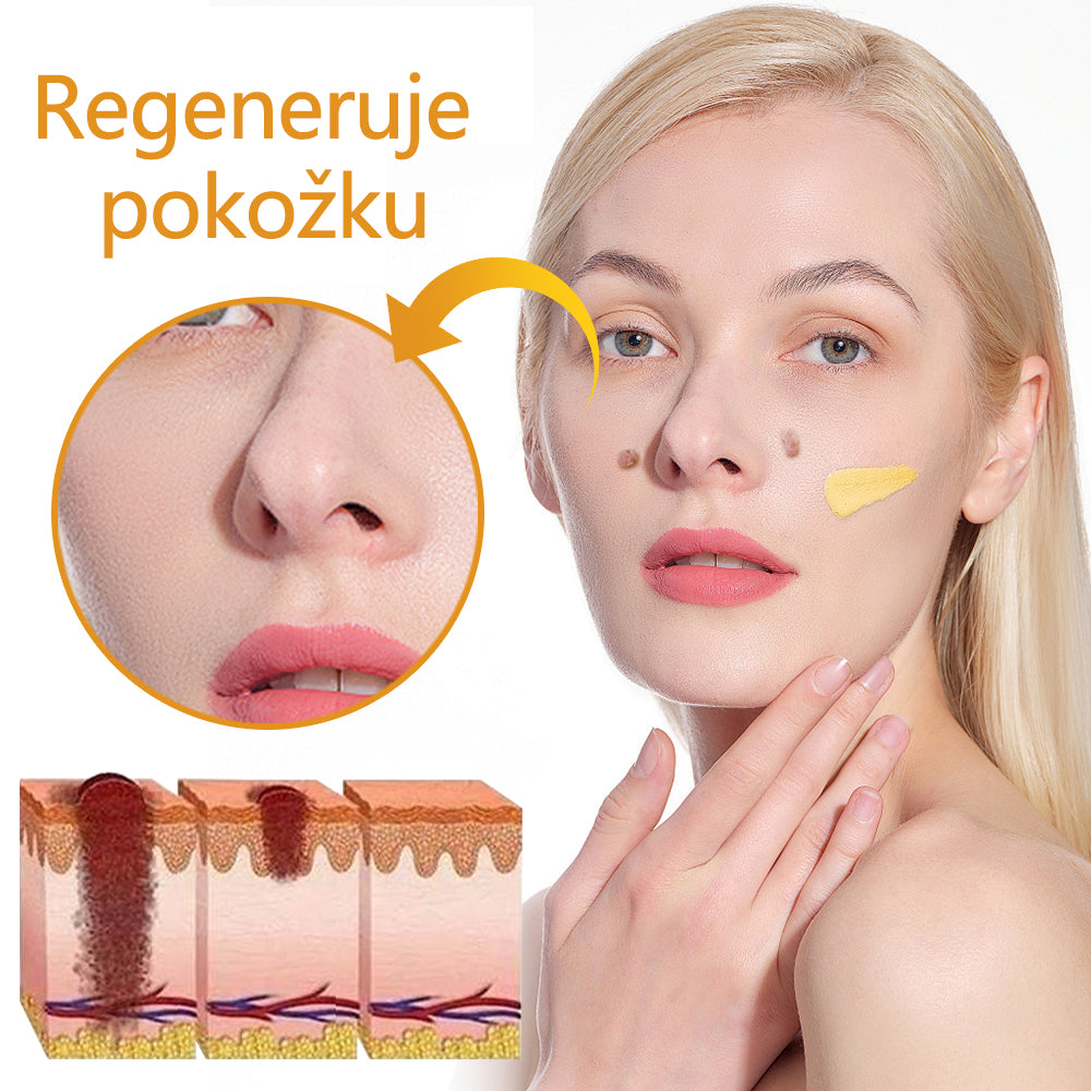 Twinsun™ Extra Silný Krém s včelím jedem, certifikovaný EMA💖 Na ošetření bradavic, kožních výrůstků, infekcí a keratózy, vyhlazuje nerovnoměrný povrch pokožky🐝