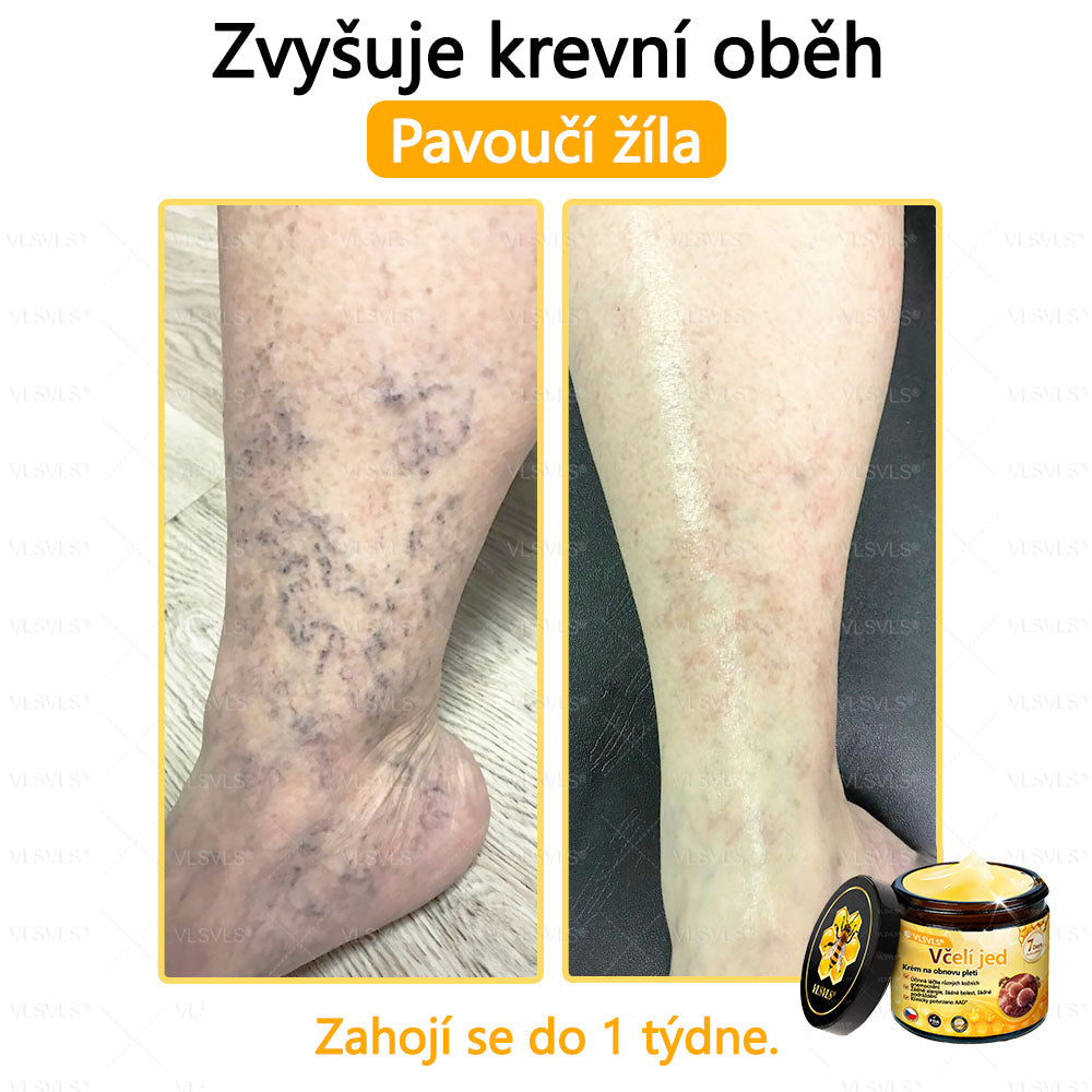 🐝VLSVLS™ Krém s včelím jedem – doporučeno kožními lékaři 🧑⚕️ Na různé kožní problémy – fakt účinný a šetrný pomocník🍃
