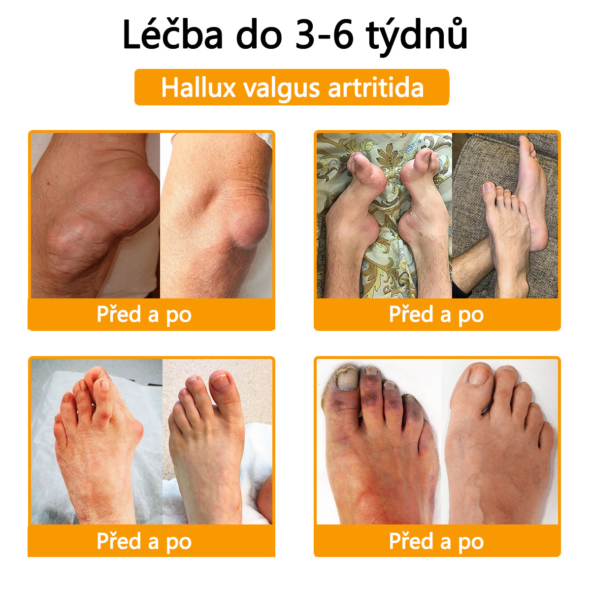 TLOPA® Krém s botulotoxinem a včelím jedem 🔥 (Speciálně pro seniory & doporučeno ortopedickými specialisty) 🐝🐝