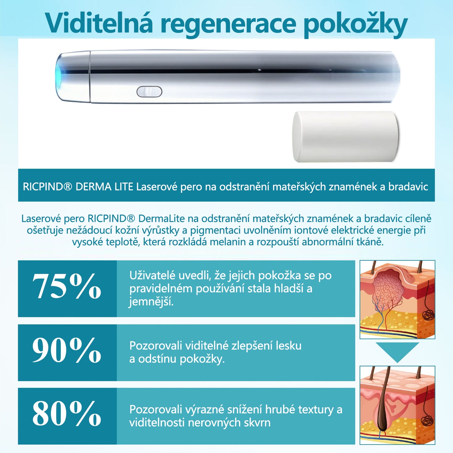RICPIND® DermaLite laserové pero na odstranění mateřských znamének a bradavic
