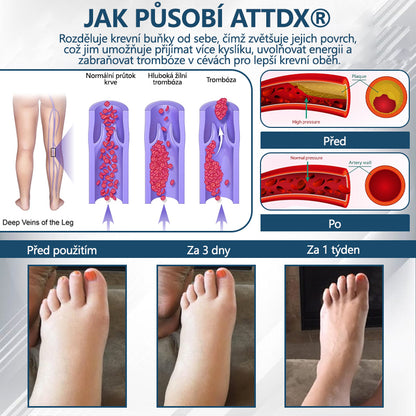 ATTDX® Černý kmín – bylinný krém na zklidnění otoků🌿🦵