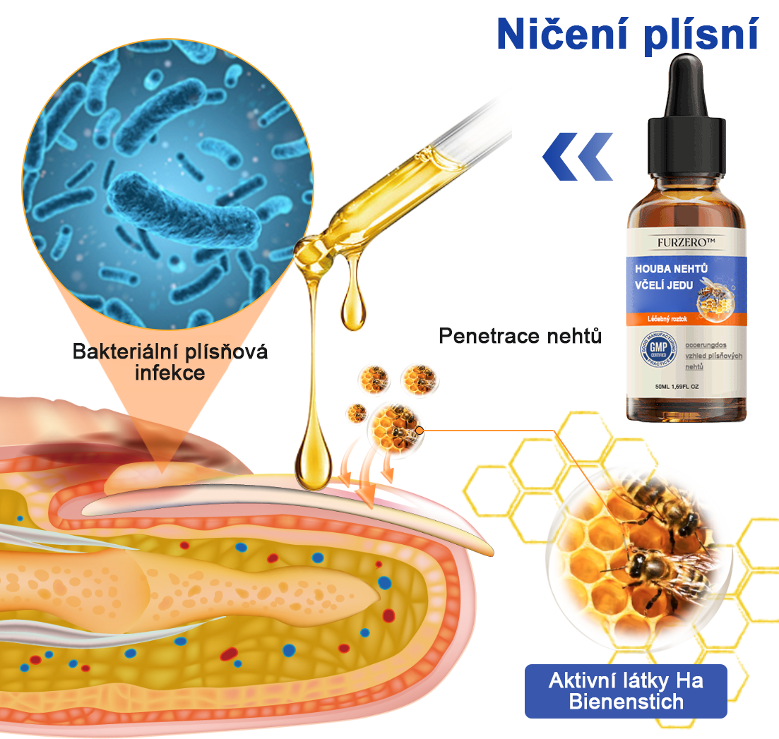 🐝Furzero™ Včelí jed na plíseň nehtů: kompletní řešení plísně nehtů 👣