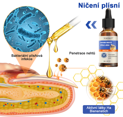 🐝Furzero™ Včelí jed na plíseň nehtů: kompletní řešení plísně nehtů 👣