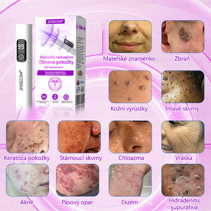 🌿𝐉𝐚𝐬𝐬𝐞𝐞𝐦® Pokročilé neinvazivní pero s CO₂ laserem na opravu pokožky 💕 (šetrně odstraňuje bradavice, mateřská znaménka, stařecké skvrny a kožní značky - bez bolesti a rozruchu!)🌿