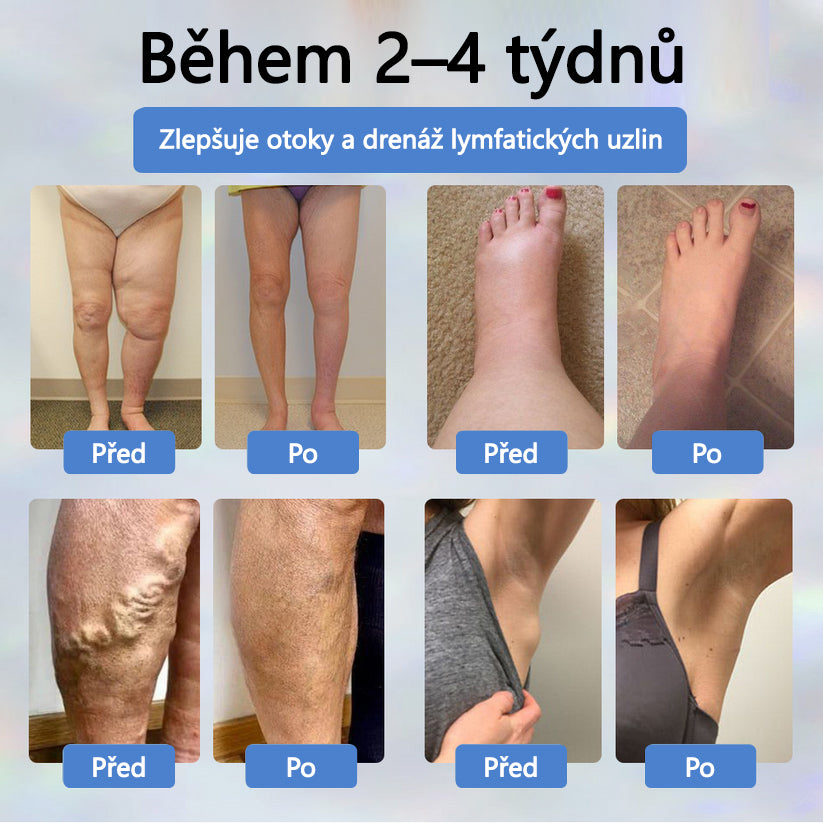 ATTDX® Černý kmín – bylinný krém na zklidnění otoků🌿🦵