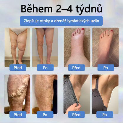 ATTDX® Černý kmín – bylinný krém na zklidnění otoků🌿🦵