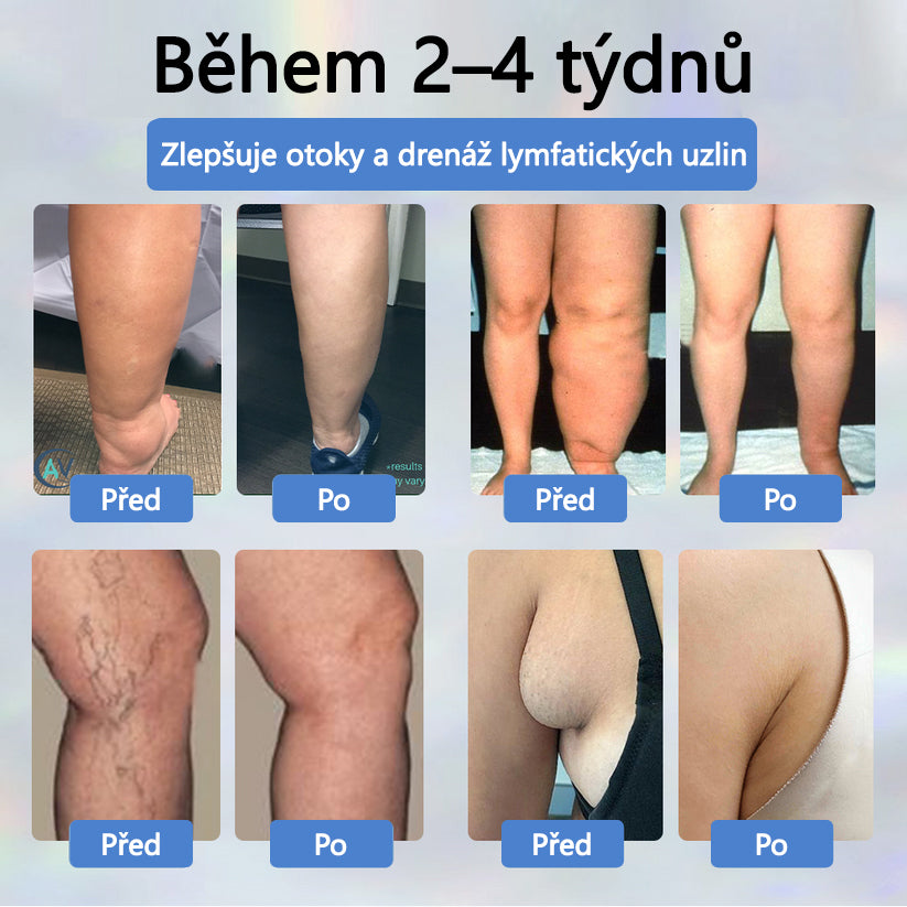 ATTDX® Černý kmín – bylinný krém na zklidnění otoků🌿🦵
