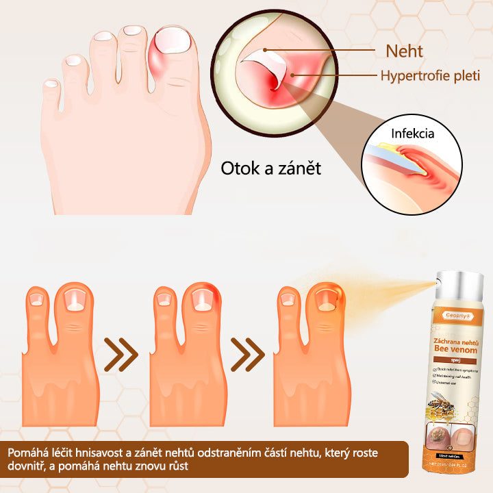 💥 2025 Limitovaná 70% SLEVA ️⏳ Ceoerty® NailRescue Kolirin sprej proti plísním nehtů s včelím jedem 💥 Všechny problémy s nehty vyléčíte během 2 týdnů🐝