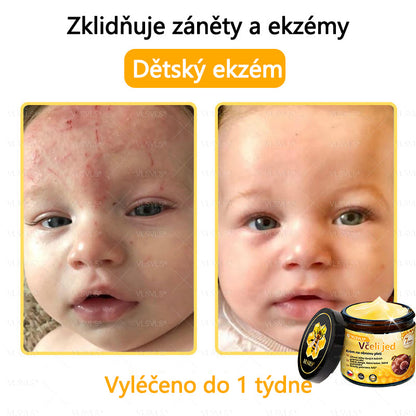 🐝VLSVLS™ Krém s včelím jedem – doporučeno kožními lékaři 🧑‍⚕️ Na různé kožní problémy – fakt účinný a šetrný pomocník
