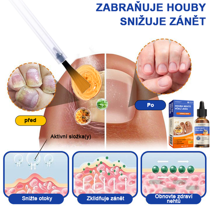 🐝Furzero™ Včelí jed na plíseň nehtů: kompletní řešení plísně nehtů 👣
