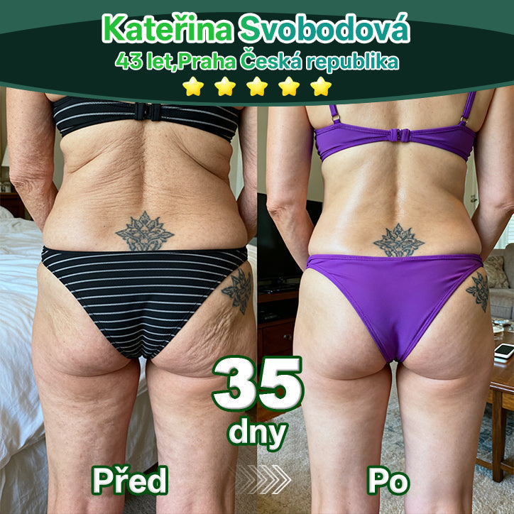 Lékárna Na Poště | 𝐿𝑜𝑡𝑚𝑎𝑦® Kapky s kmenovými buňkami a kolagenovými peptidy pro vnitřní použití  💧 (Zpevnění a lifting povolené pokožky & redukce tvorby vrásek) ❤️‍🔥（副本）